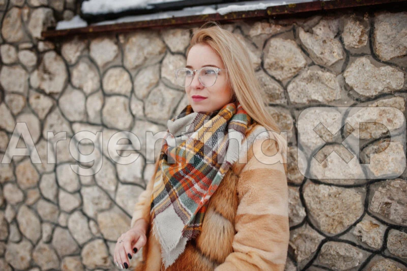 Foto 2 Deshacerse de un chupetón – Consejos para eliminar los chupones